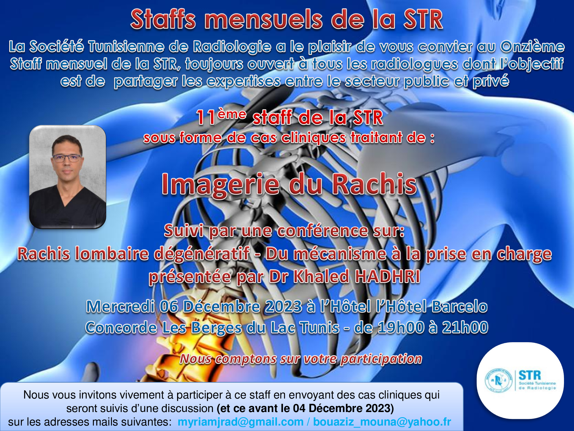 11ème Staff de la STR